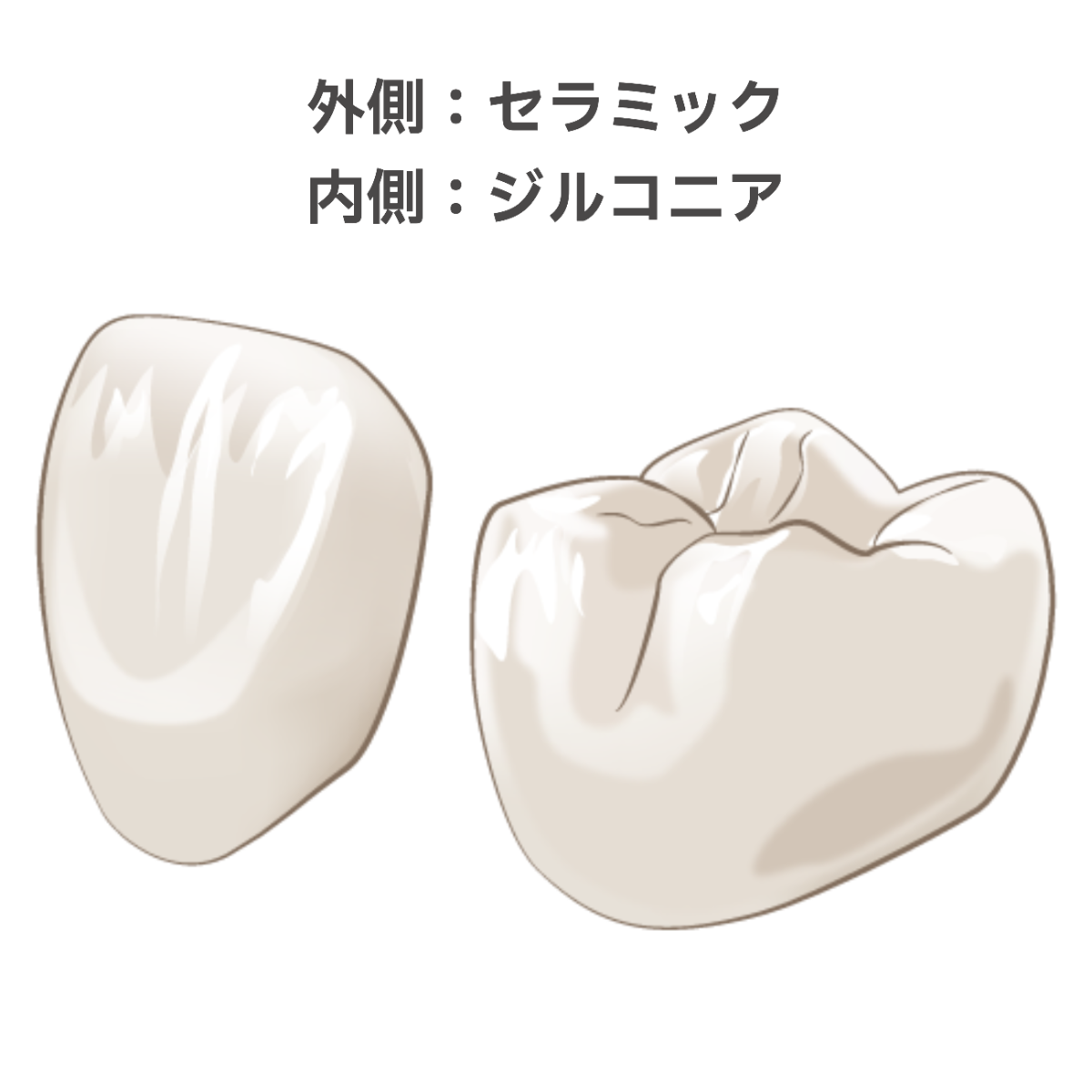 ジルコニアセラミック