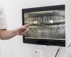 充実した検査機器で精密な診断・高精度な治療を実現