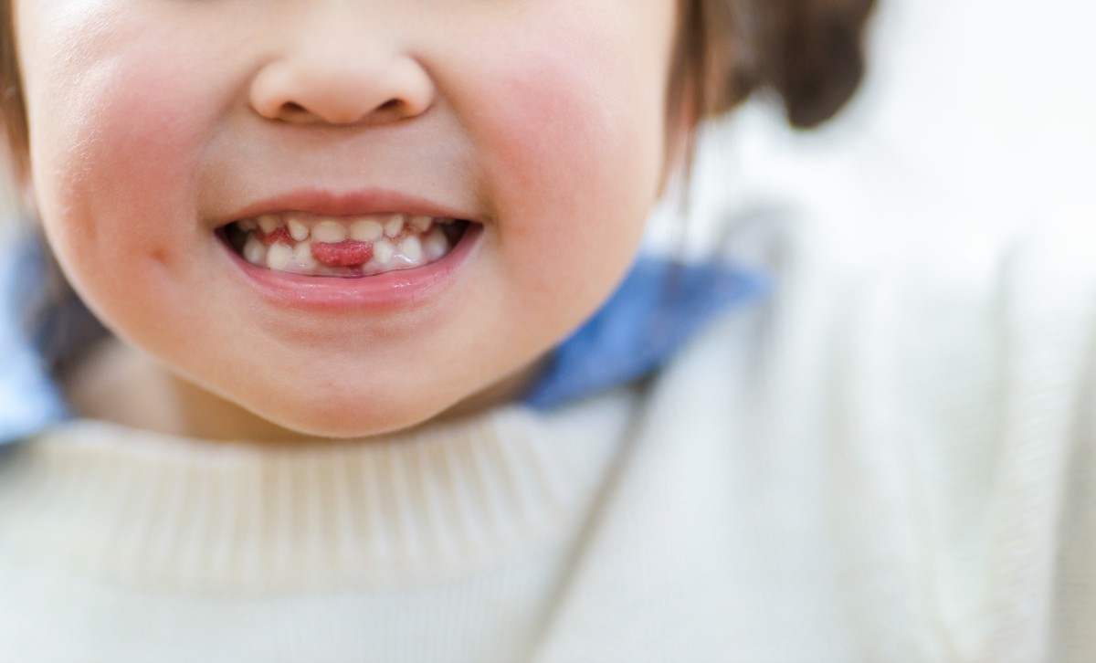 歯医者さんに通うのはいつから？